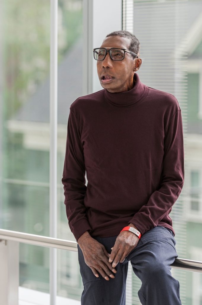 Robert Chelsea, the first African American to receive a full face transplant, sits on a railing in front of a window. He wears glasses and a maroon sweater.